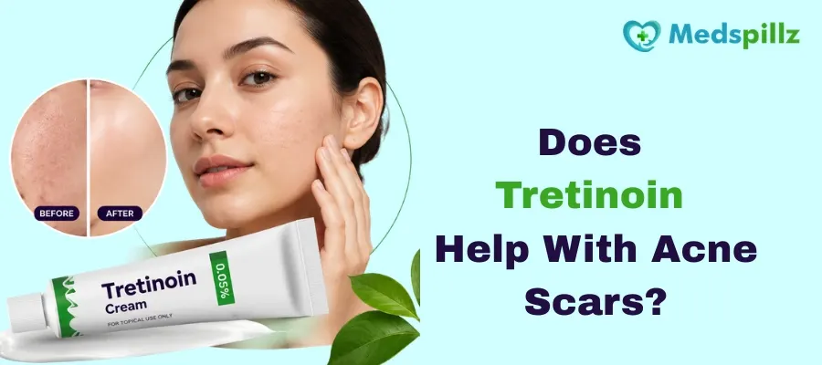 Does Tretinoin Help With Acne Scars?