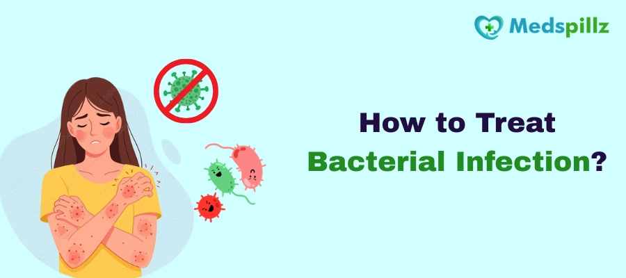 How to Treat Bacterial Infection?